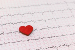 arrhythmia